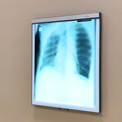 1 Bay Slimline LED XRay Viewer X Ray Light Box